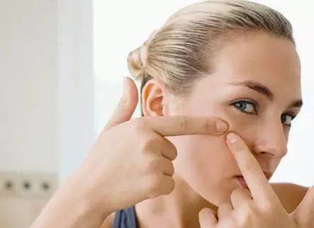 祛痘誤區以及祛痘方法