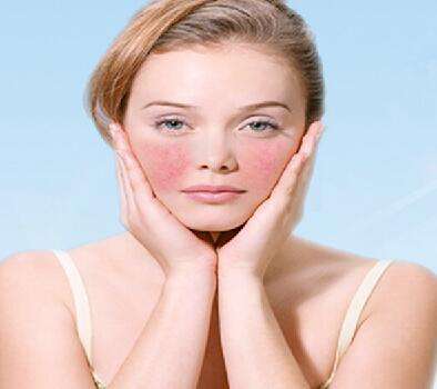 臉部過(guò)敏怎么辦